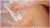 Эпилятор Philips BRE710/00 Epilator Series 8000